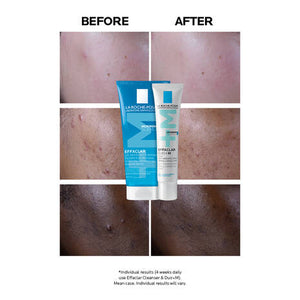 La Roche-Posay Effaclar Duo+M: Anti-Blemish Corrective Gel (Damaged Box)