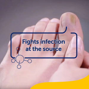 Schollmed Once Weekly Fungal Nail Treatment 5% W/V Medicated Nail Lacquer